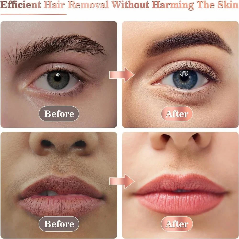 Rechargeable Hair Remover for Women